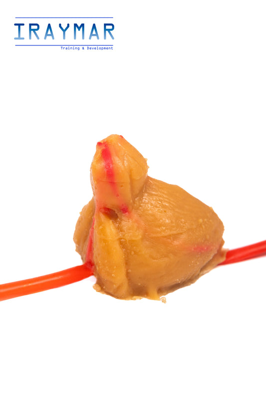 Módulo de próstata y vejiga (parcial)