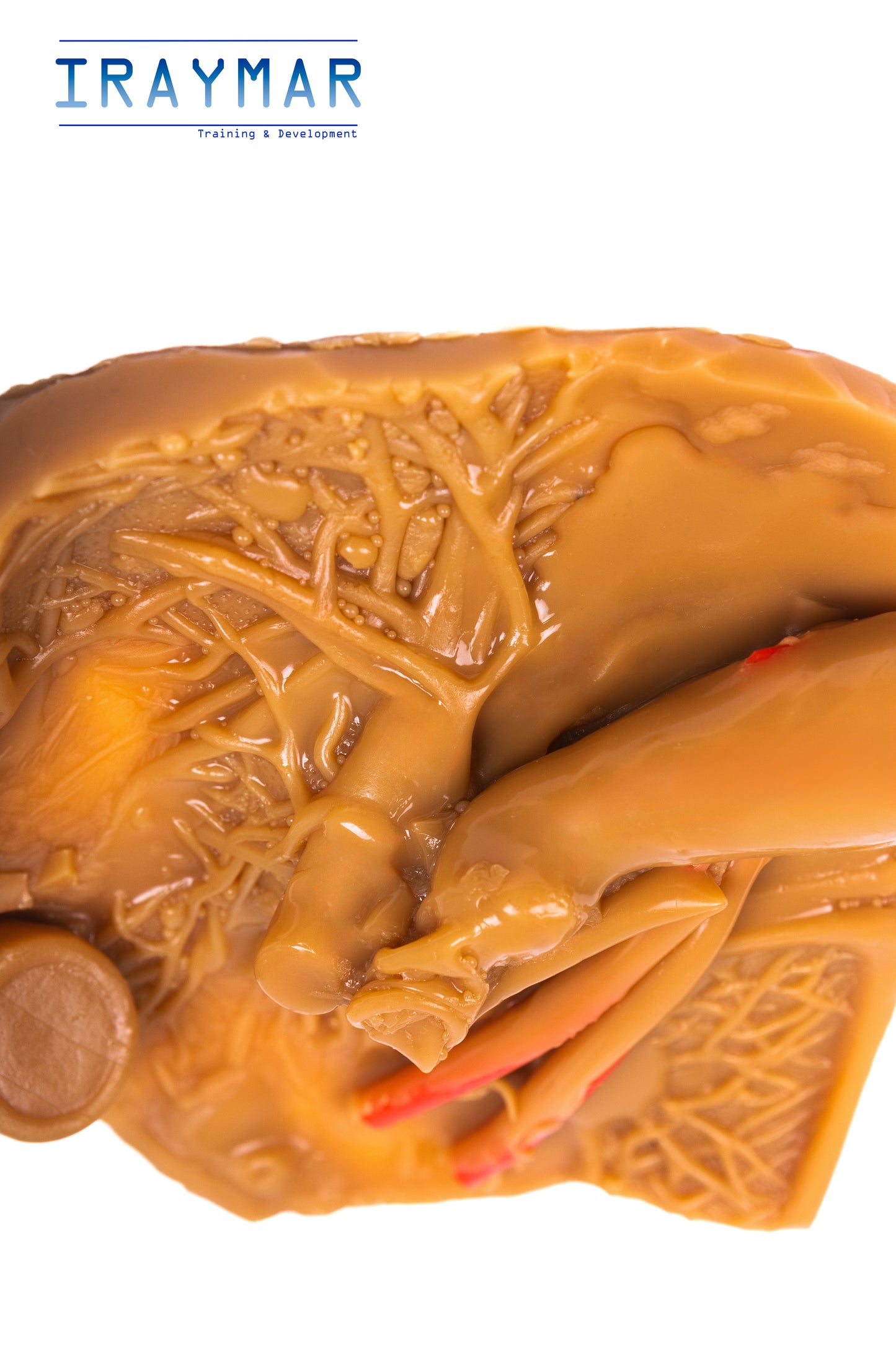 Módulo de vesícula