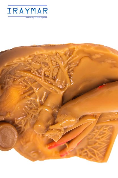 Módulo de vesícula